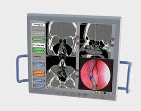 Image Guided Navigation Scan