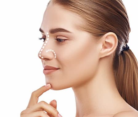 Rhinoplasty