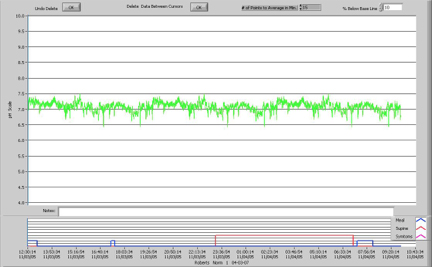 Normal Tracings Scan