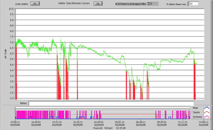 Severe Nocturnal Reflux Scan