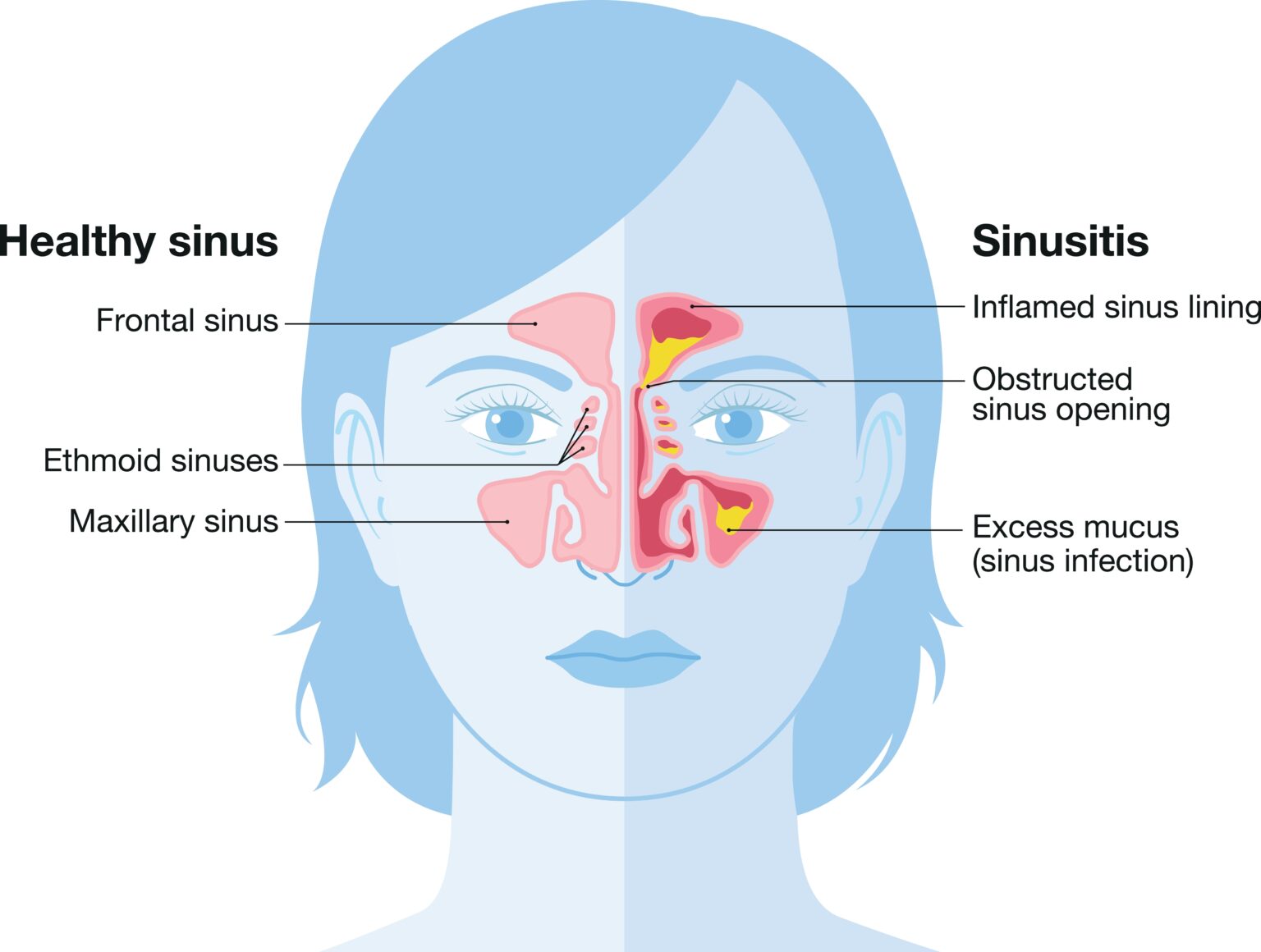 do sinus mattresses come in different firmness set