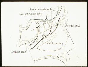 Frontal and ethmoidal mucociliary clearance And Maxillary mucociliary clearance