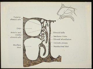The paranasal sinuses are lined with respiratory epithelium